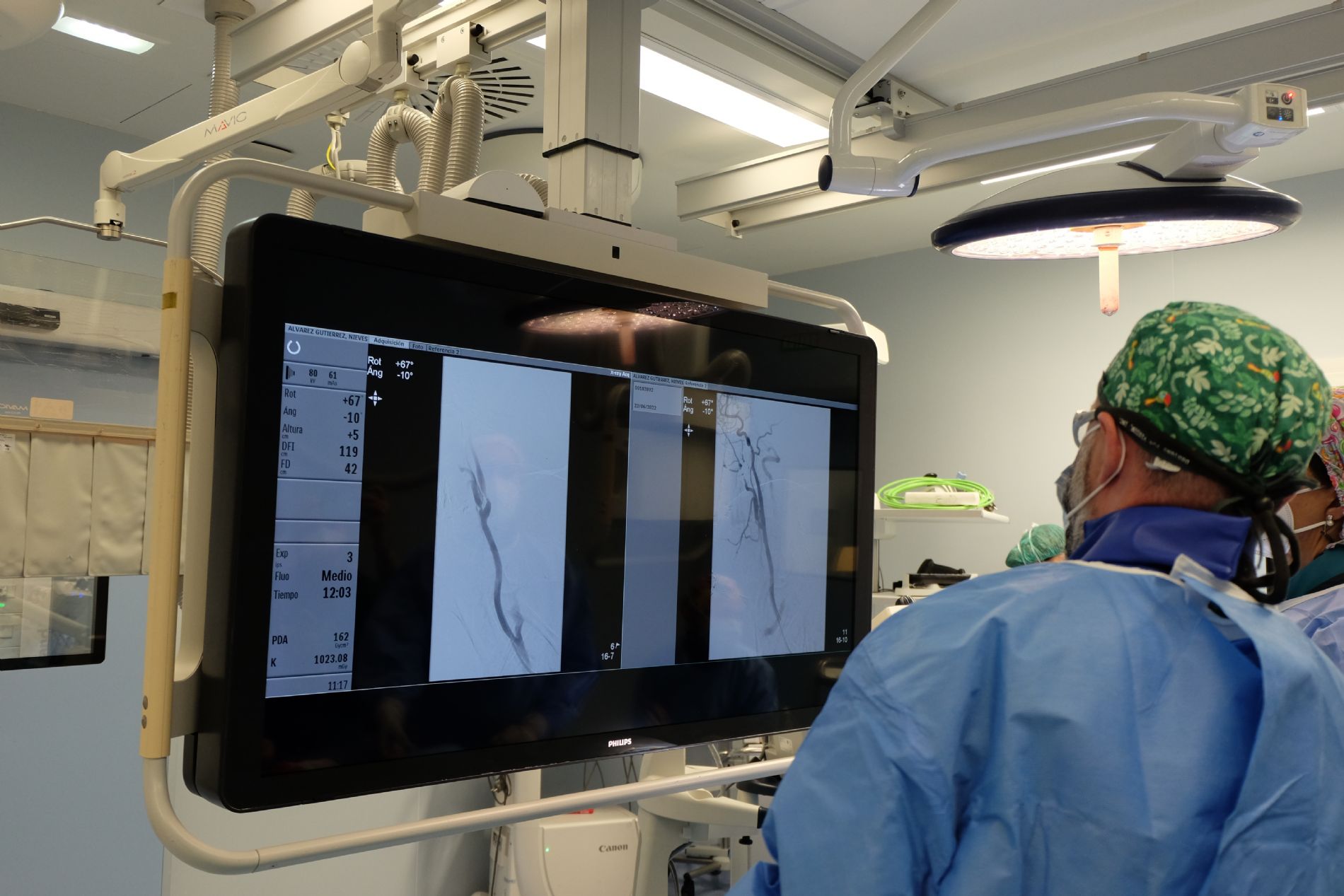 El Centro Mdico de Asturias implanta con xito el segundo stent carotdeo