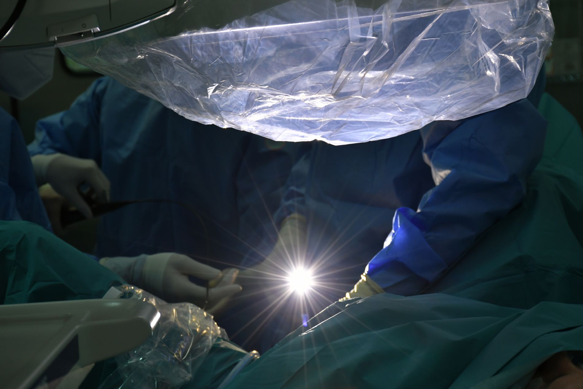 Fotolitotricia con lser para eliminar clculos por ureteroscopia