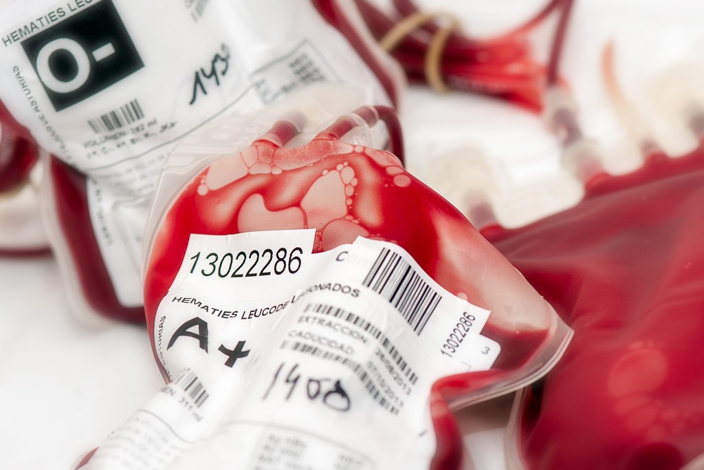 Hematologa y Hemoterapia_1