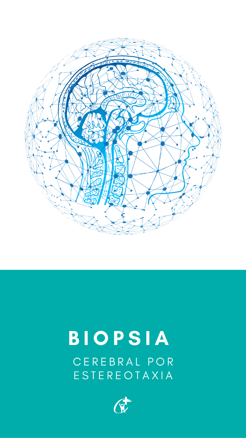 Biopsia cerebral con estereotaxia