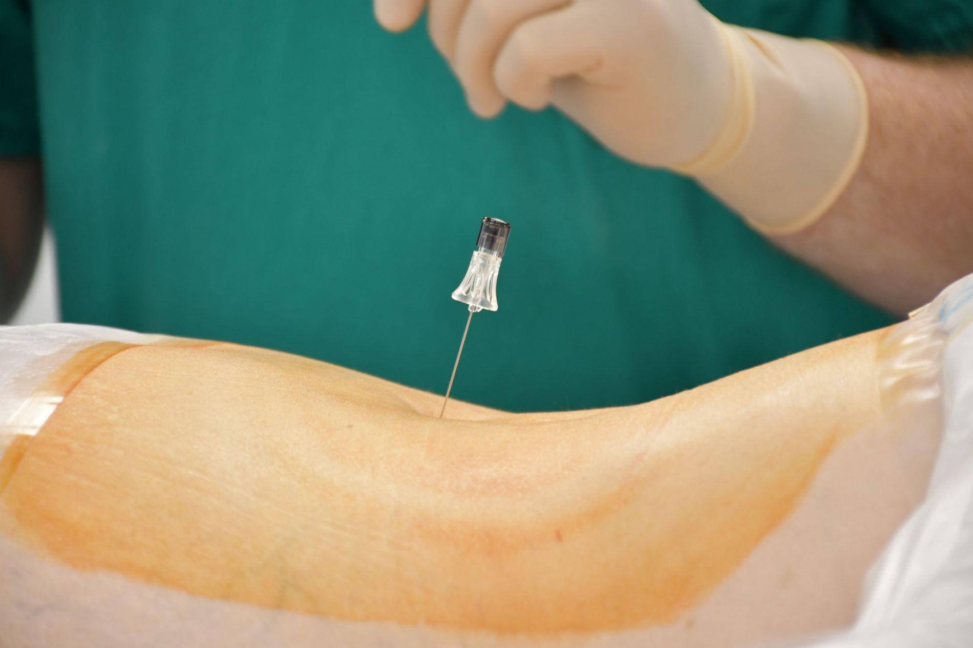 El Hospital Centro Mdico de Asturias realiza la primera ciruga de estenosis de canal mediante endoscopia biportal en Asturias