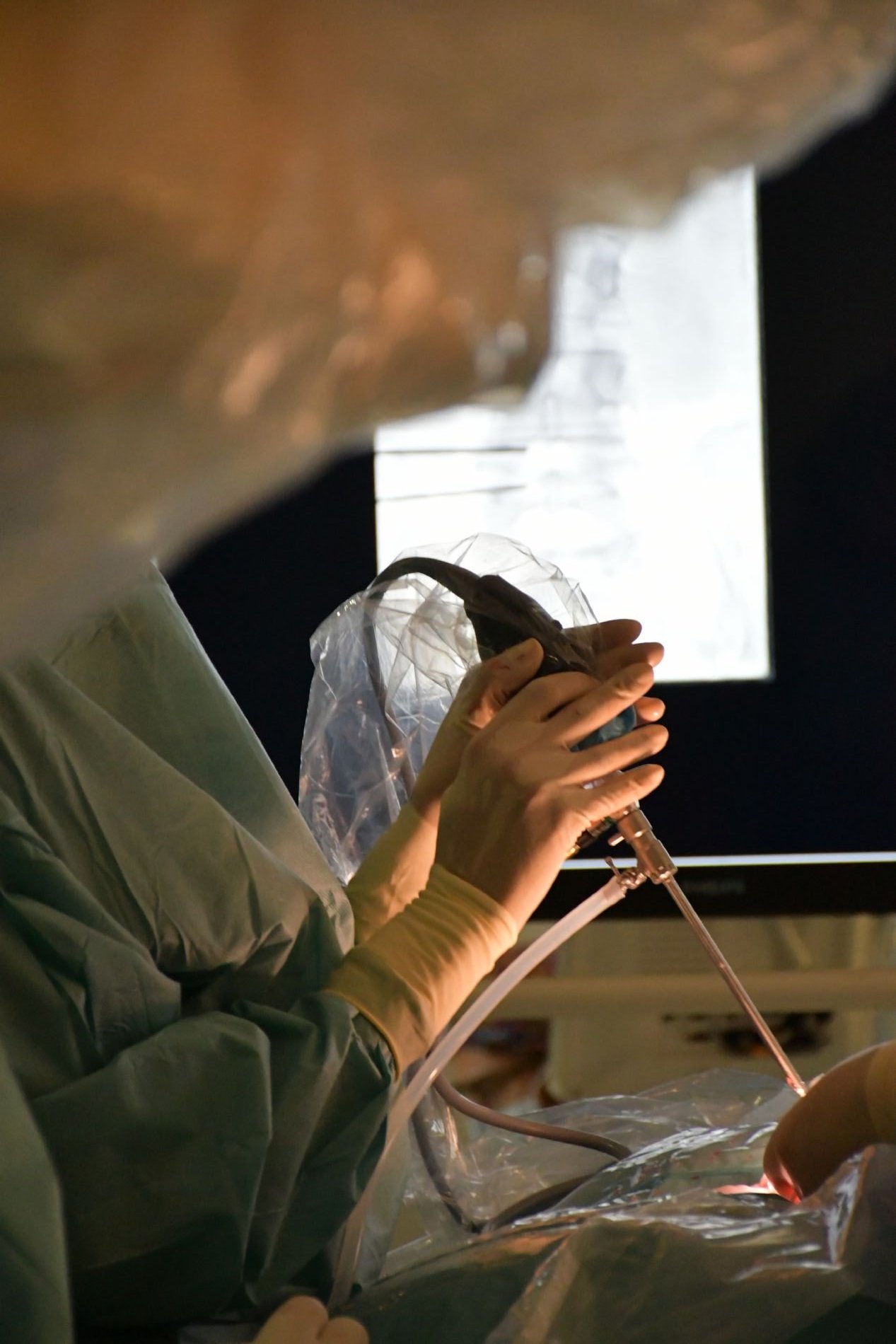 El Hospital Centro Mdico de Asturias realiza la primera ciruga de estenosis de canal mediante endoscopia biportal en Asturias