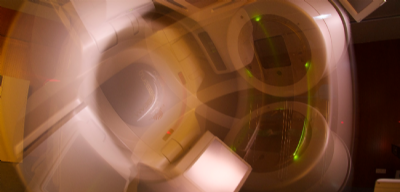 10 mitos de la radioterapia
