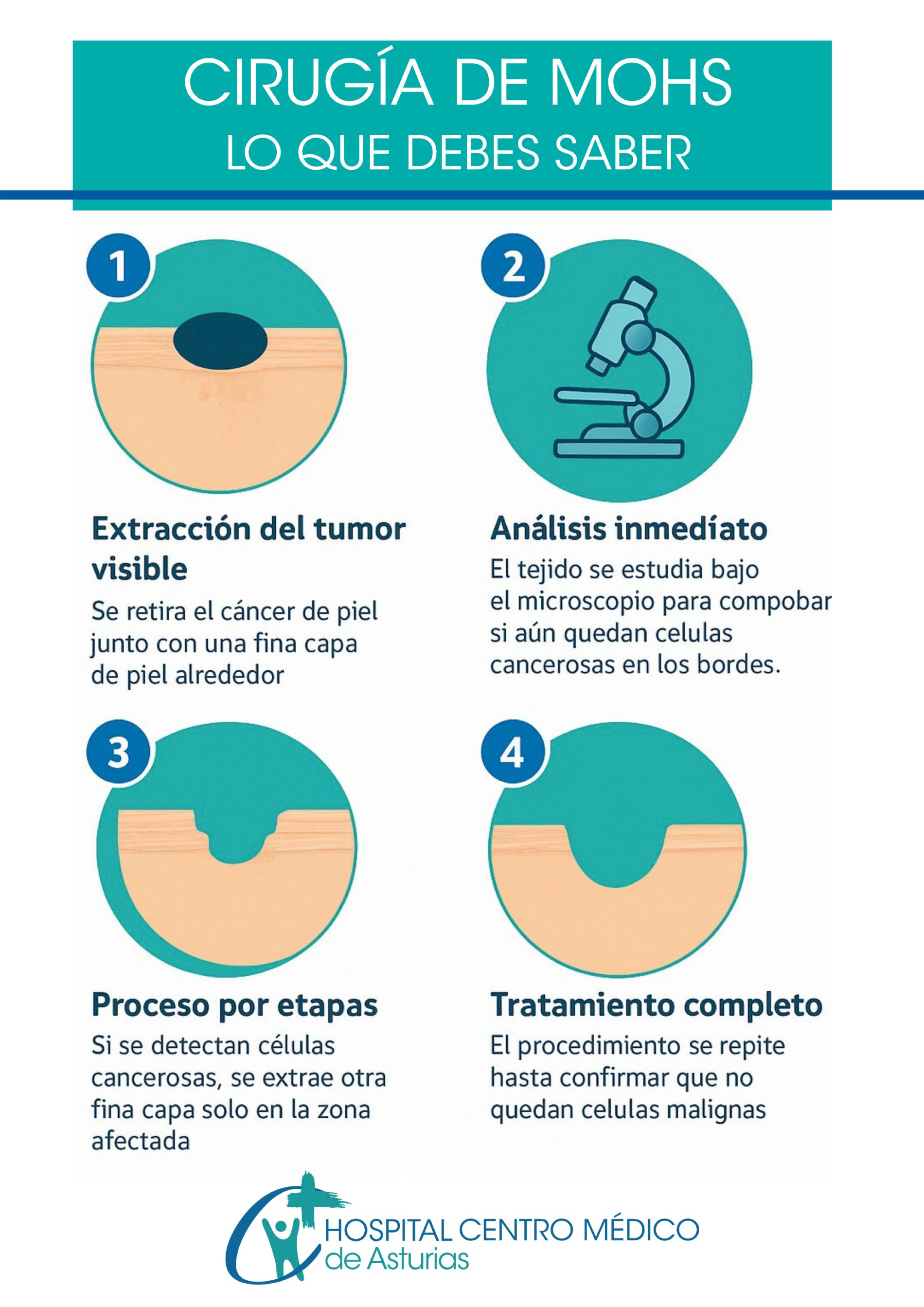 Radioterapia