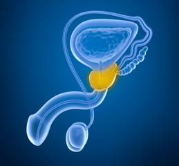 El Cáncer de próstata se puede prevenir con un diagnóstico precoz.